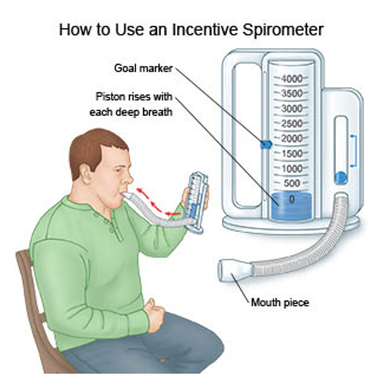 How to Use an Incentive Spirometer