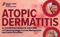 Atopic Dermatitis: A Comprehensive Review of Pathophysiology, Current Management and Future Directions